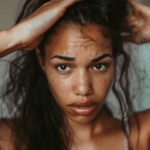 How Stress and Anxiety Cause Hair Loss