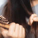 telogen effluvium in women