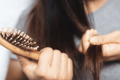 telogen effluvium in women