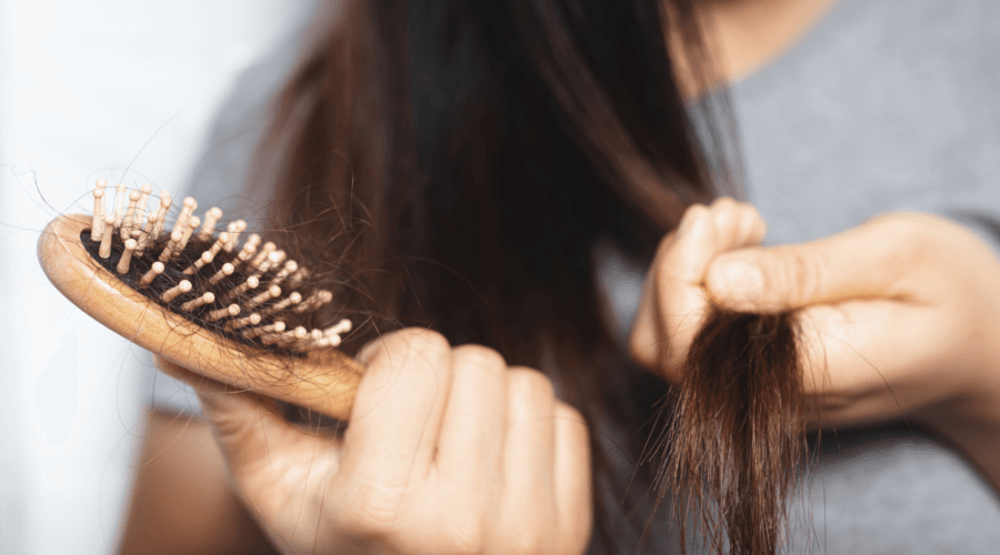 telogen effluvium in women